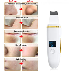 Ultrasonic Skin Scrubber: Facial Cleansing